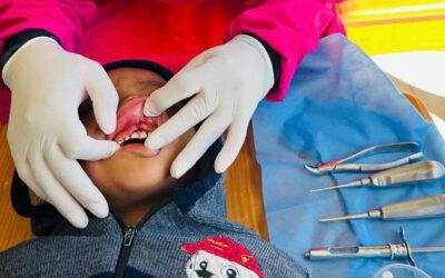 La prevención: el mejor tratamiento dental